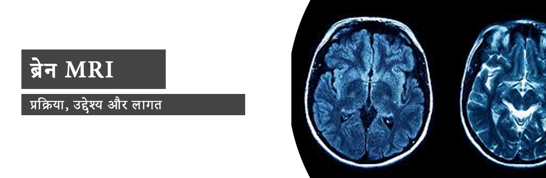 ब्रेन MRI: प्रक्रिया, उद्देश्य, लागत और दिल्ली में सर्वश्रेष्ठ MRI केंद्र।